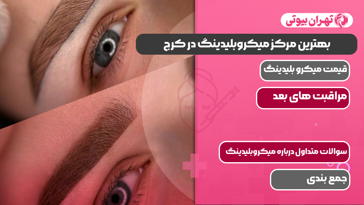 10 تا از بهترین مرکز میکروبلیدینگ در کرج