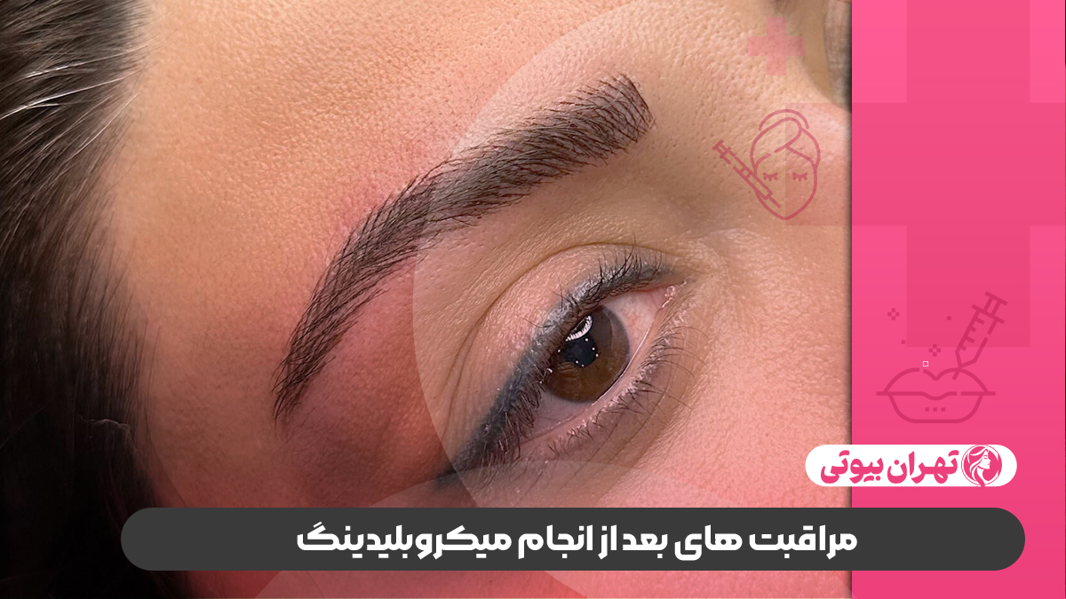 10 تا از بهترین مرکز میکروبلیدینگ در کرج