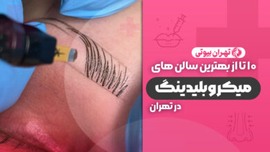 10 تا از بهترین مرکز میکروبلیدینگ در تهران