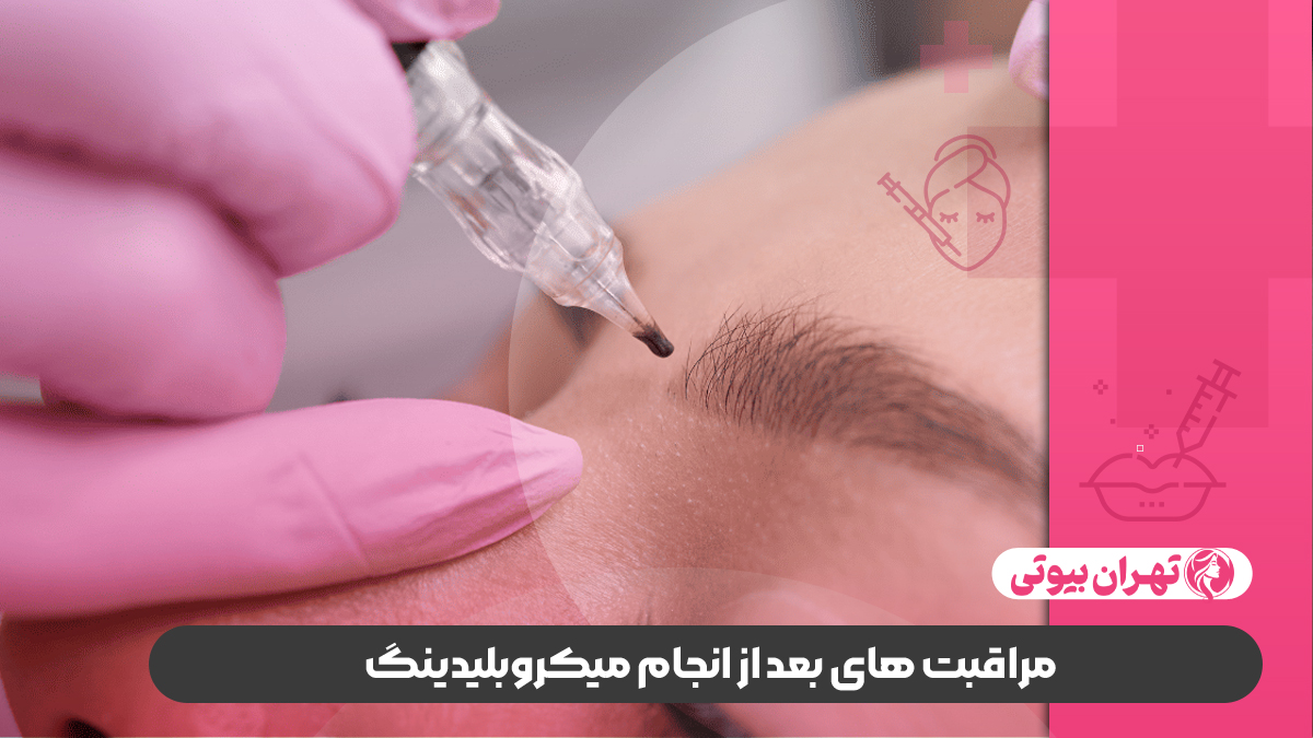 10 تا از بهترین مرکز میکروبلیدینگ در تهران