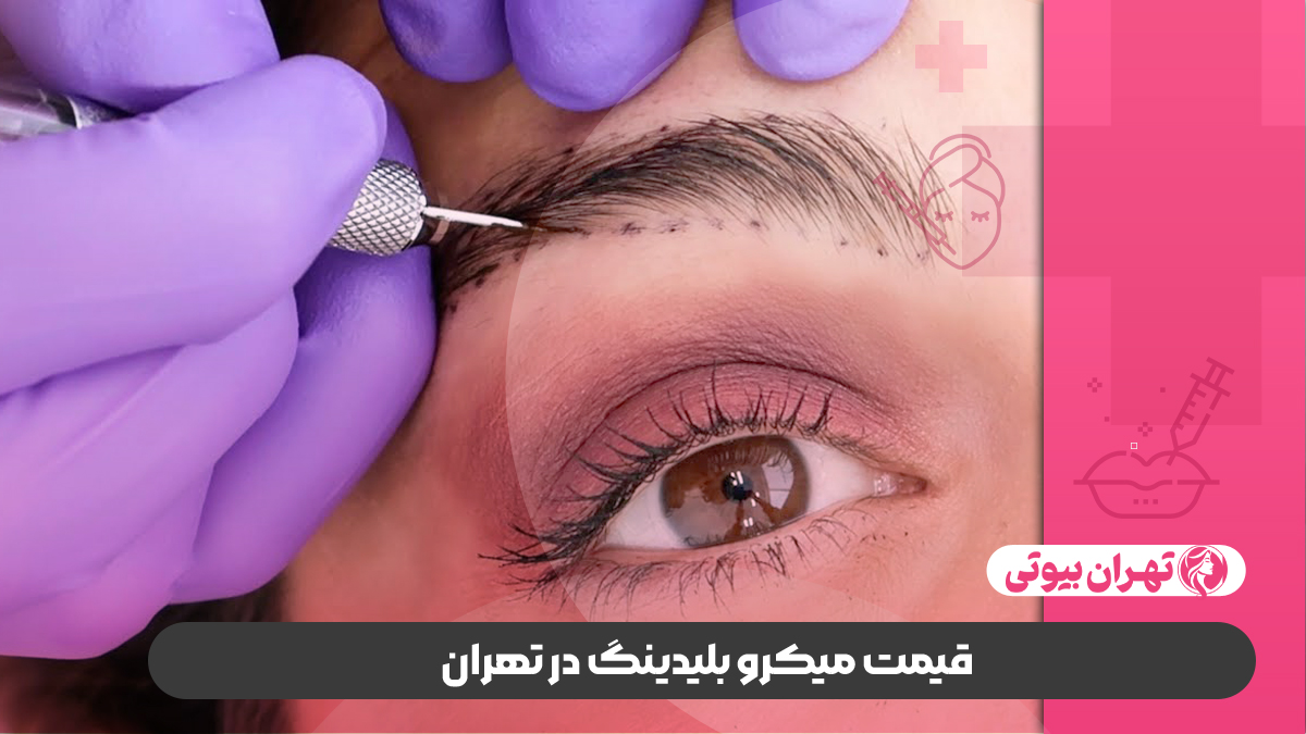 10 تا از بهترین مرکز میکروبلیدینگ در تهران