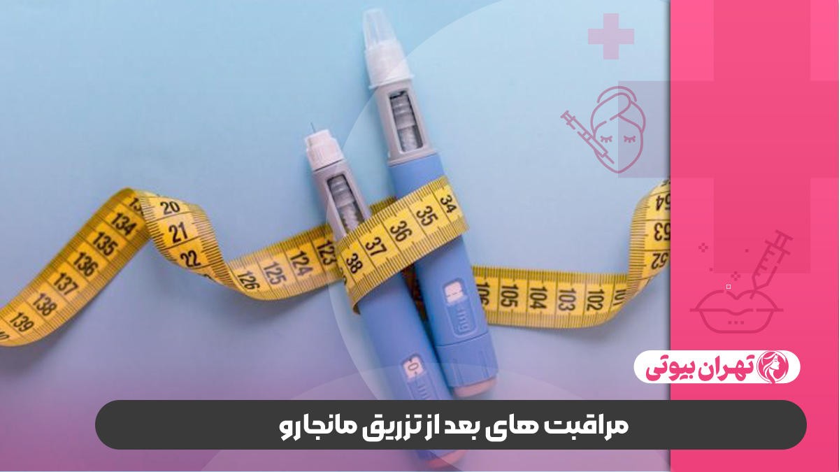 10 بهترین مرکز تزریق مانجارو در کرج