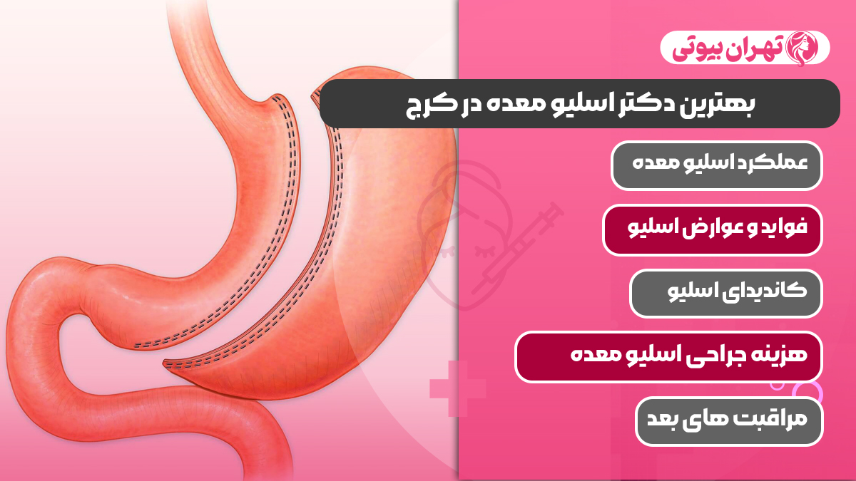 10 بهترین دکتر اسلیو معده در کرج
