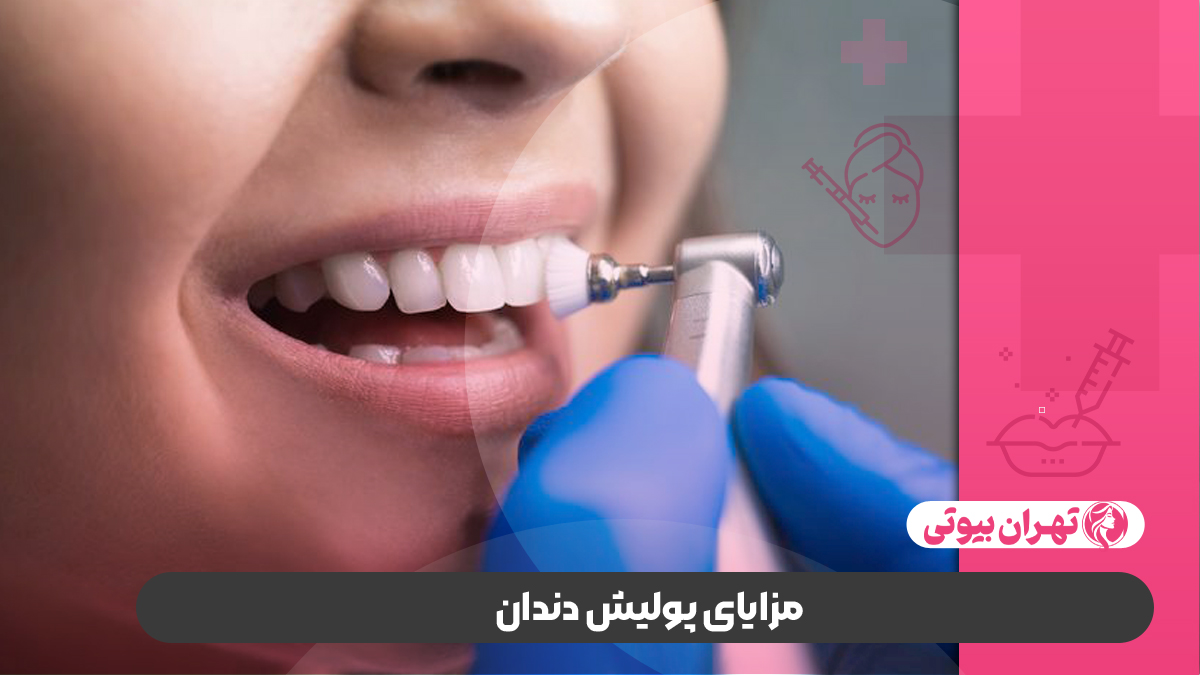 10 بهترین دکتر پولیش دندان در کرج