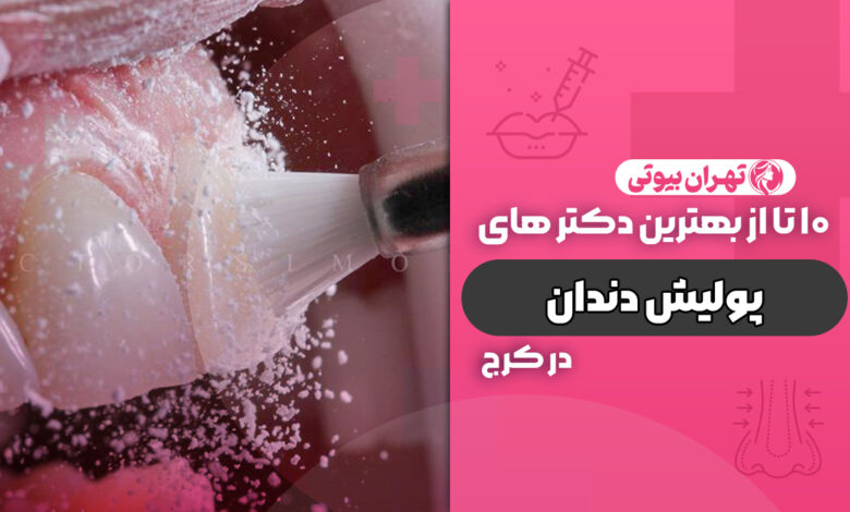 10 بهترین دکتر پولیش دندان در کرج