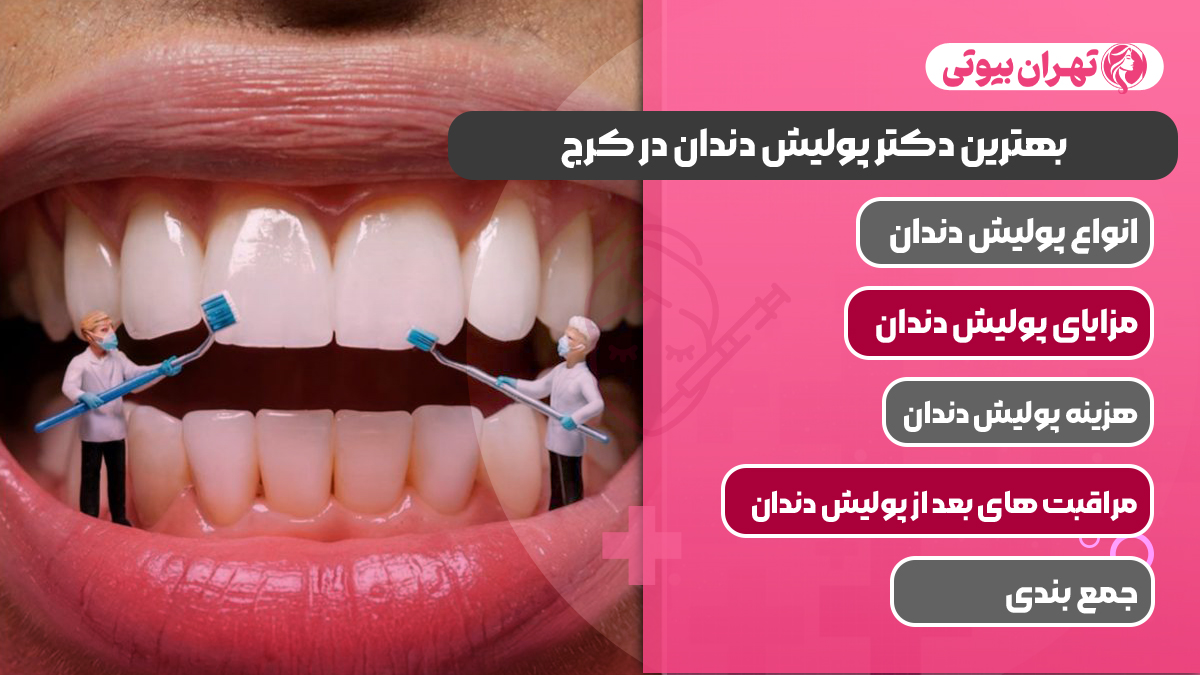 10 بهترین دکتر پولیش دندان در کرج