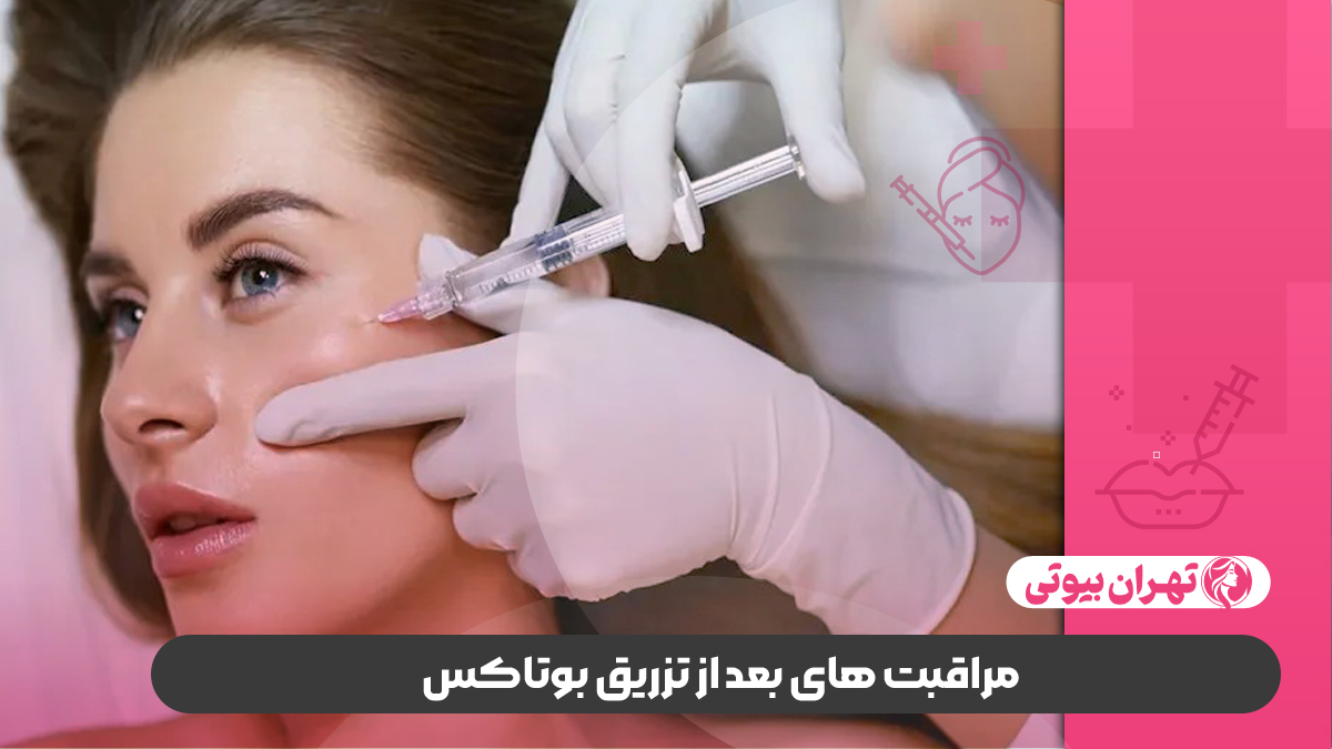 بهترین دکتر تزریق بوتاکس در غرب تهران