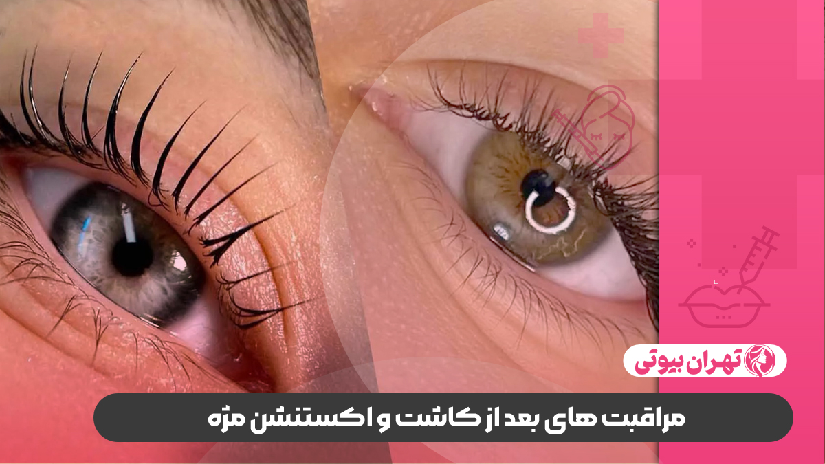 10 بهترین مرکز اکستنشن مژه در شیراز