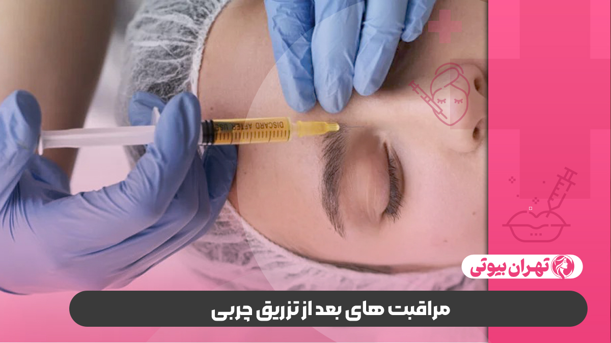 بهترین دکتر تزریق چربی در غرب تهران