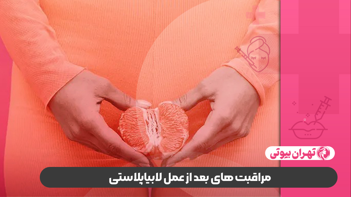 بهترین دکتر لابیاپلاستی در غرب تهران