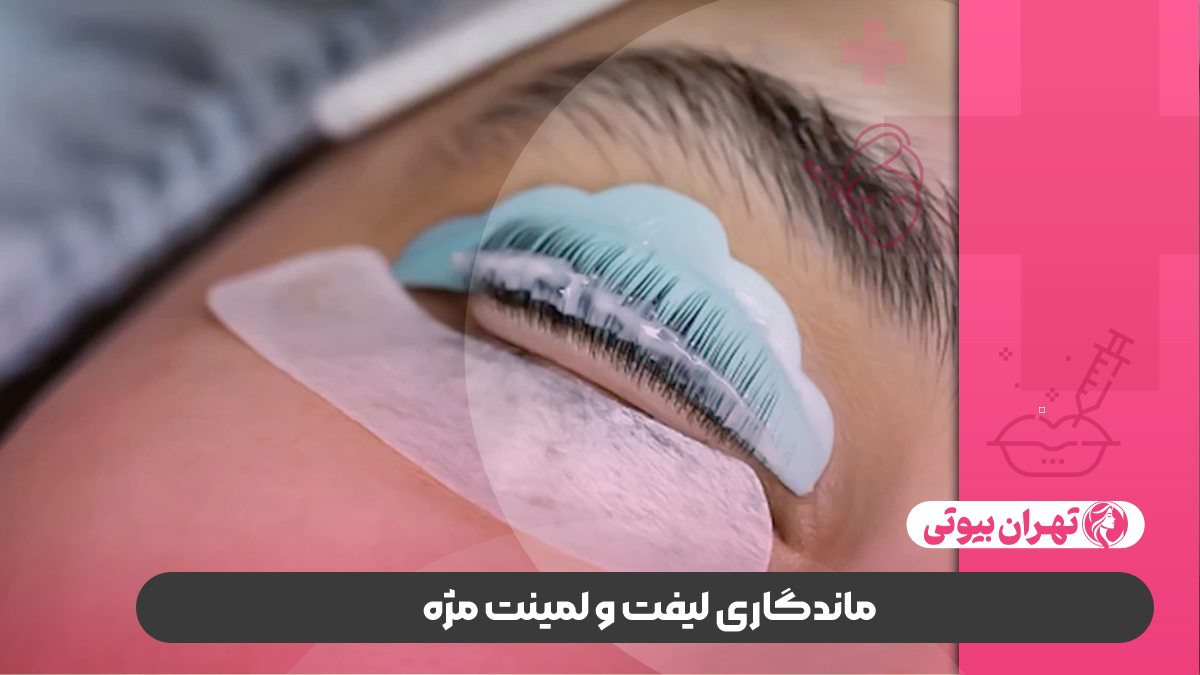 بهترین مرکز لیفت و لمینت مژه در غرب تهران