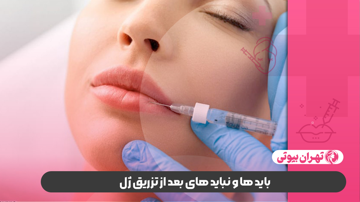 بهترین دکتر تزریق ژل در غرب تهران