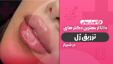 10 بهترین دکتر تزریق ژل در شیراز