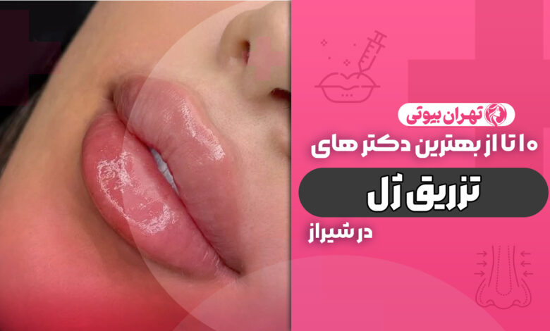 10 بهترین دکتر تزریق ژل در شیراز