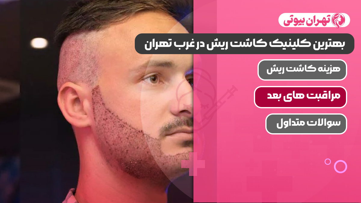 بهترین کلینیک کاشت ریش در غرب تهران