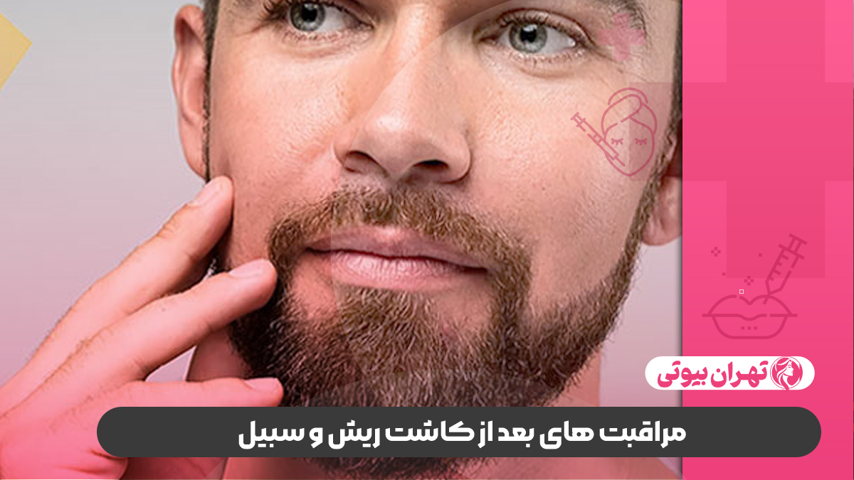 بهترین کلینیک کاشت ریش در غرب تهران