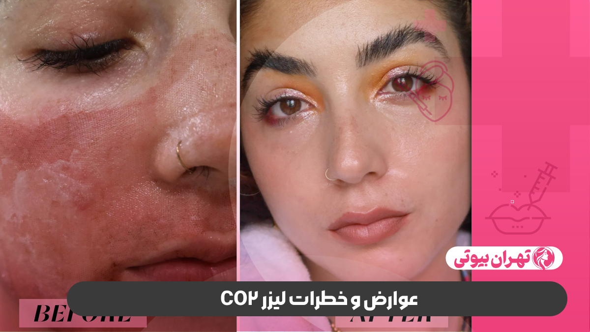 10 بهترین دکتر لیزر co2 فرکشنال در شیراز