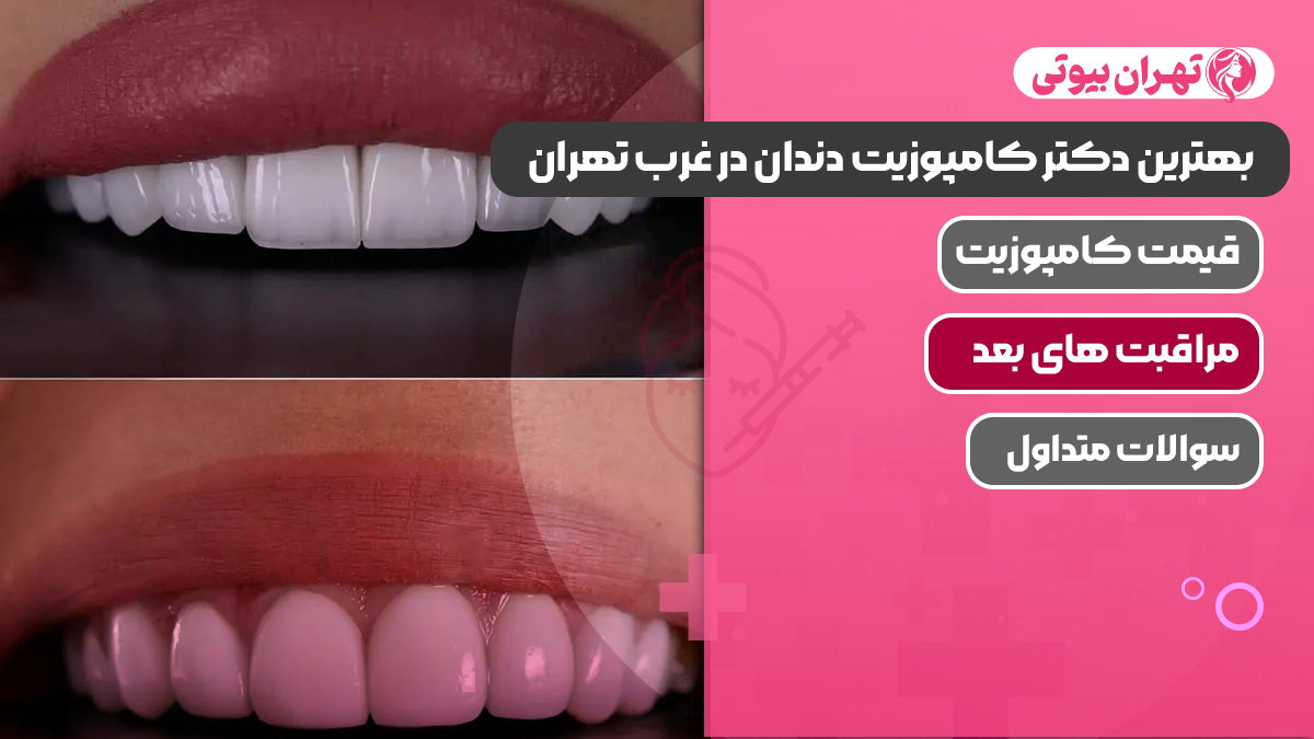 مراقبت های بعد از کامپوزیت دندان