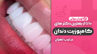 مراقبت های بعد از کامپوزیت دندان