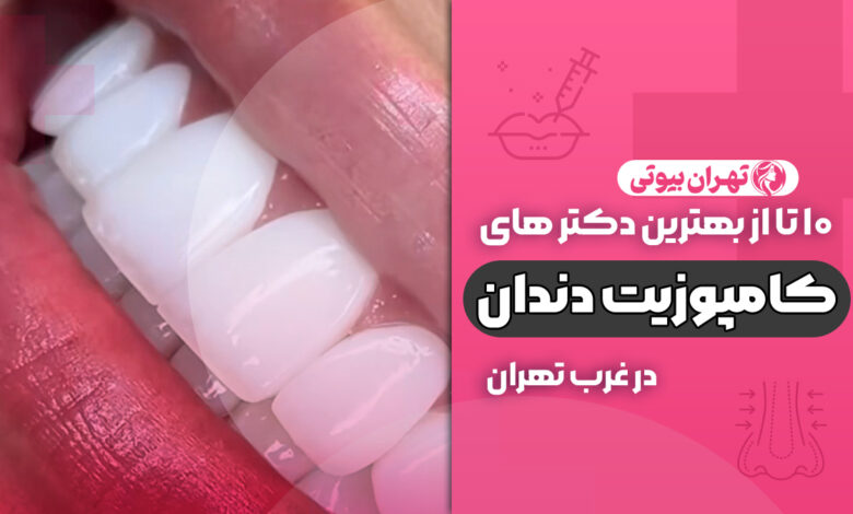 مراقبت های بعد از کامپوزیت دندان