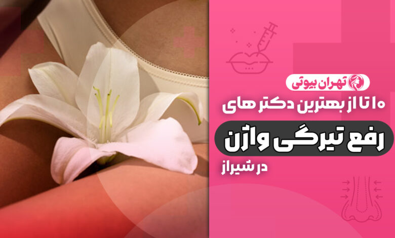 10 بهترین دکتر سفید کردن واژن در شیراز