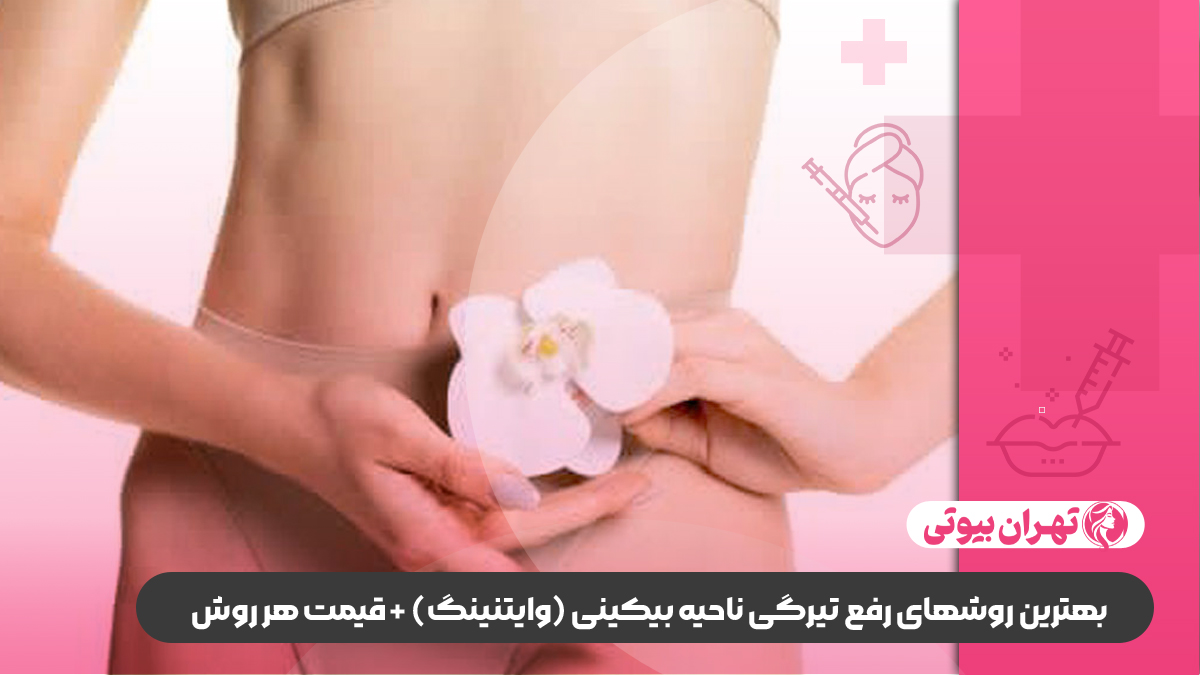 10 بهترین دکتر سفید کردن واژن در شیراز