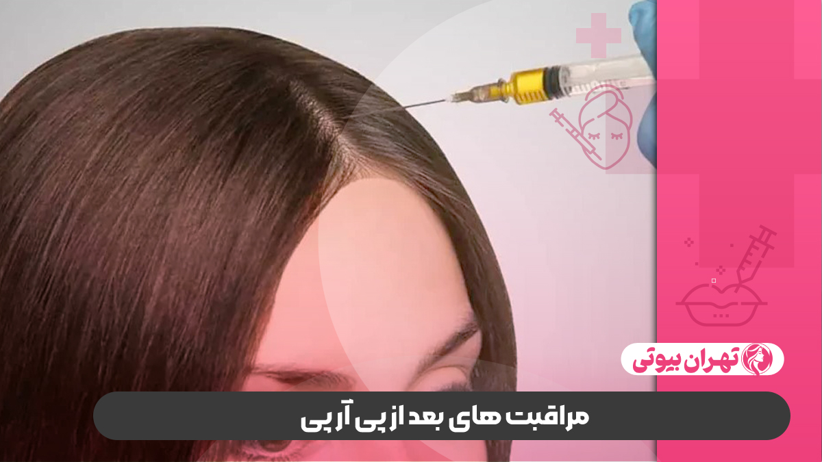 10 بهترین مرکز پی آر پی مو در شیراز