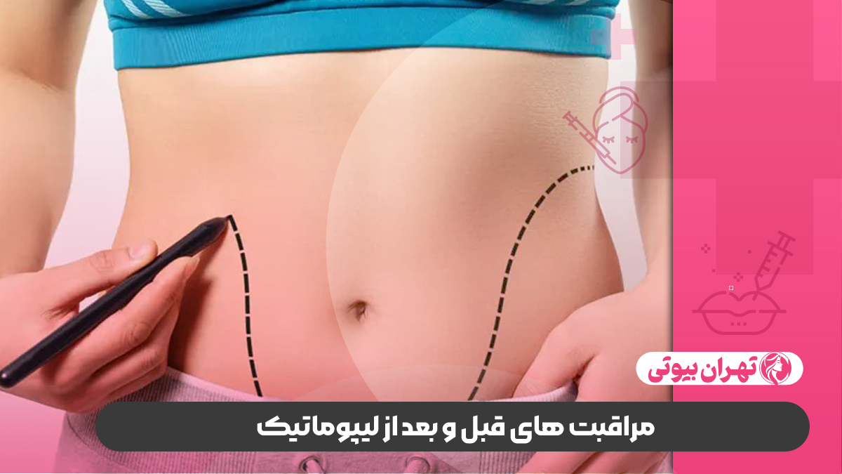 10 بهترین جراح لیپوماتیک در شیراز