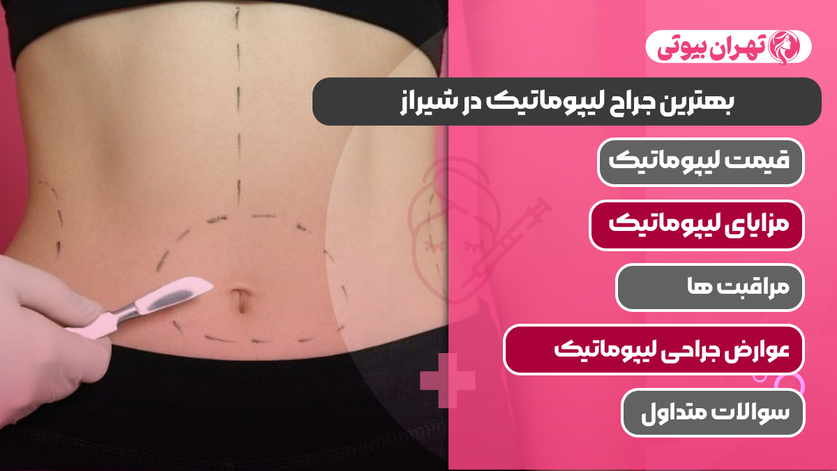 10 بهترین جراح لیپوماتیک در شیراز