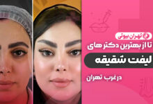 بهترین دکتر لیفت شقیقه در غرب تهران