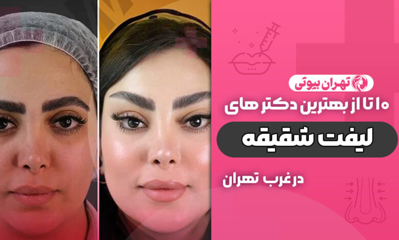بهترین دکتر لیفت شقیقه در غرب تهران