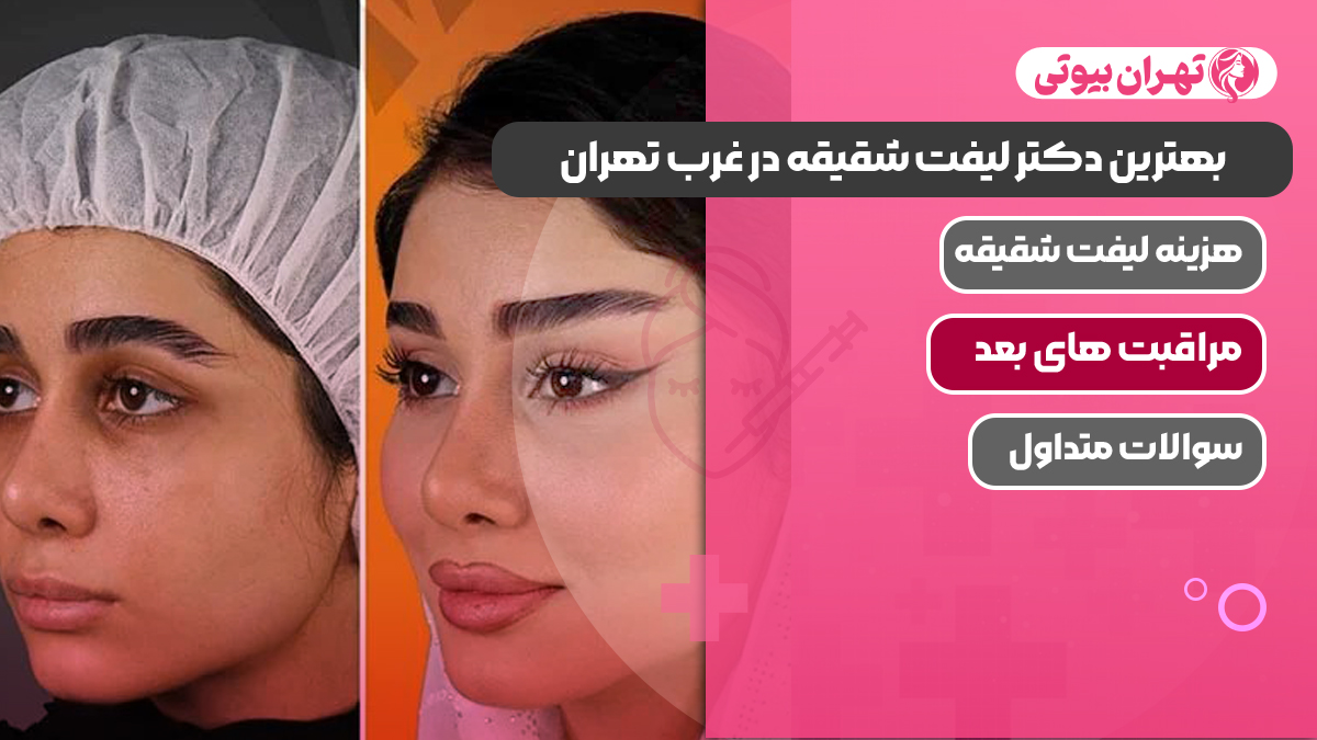 بهترین دکتر لیفت شقیقه در غرب تهران