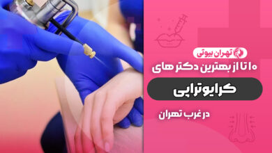 بهترین دکتر کرایوتراپی در غرب تهران