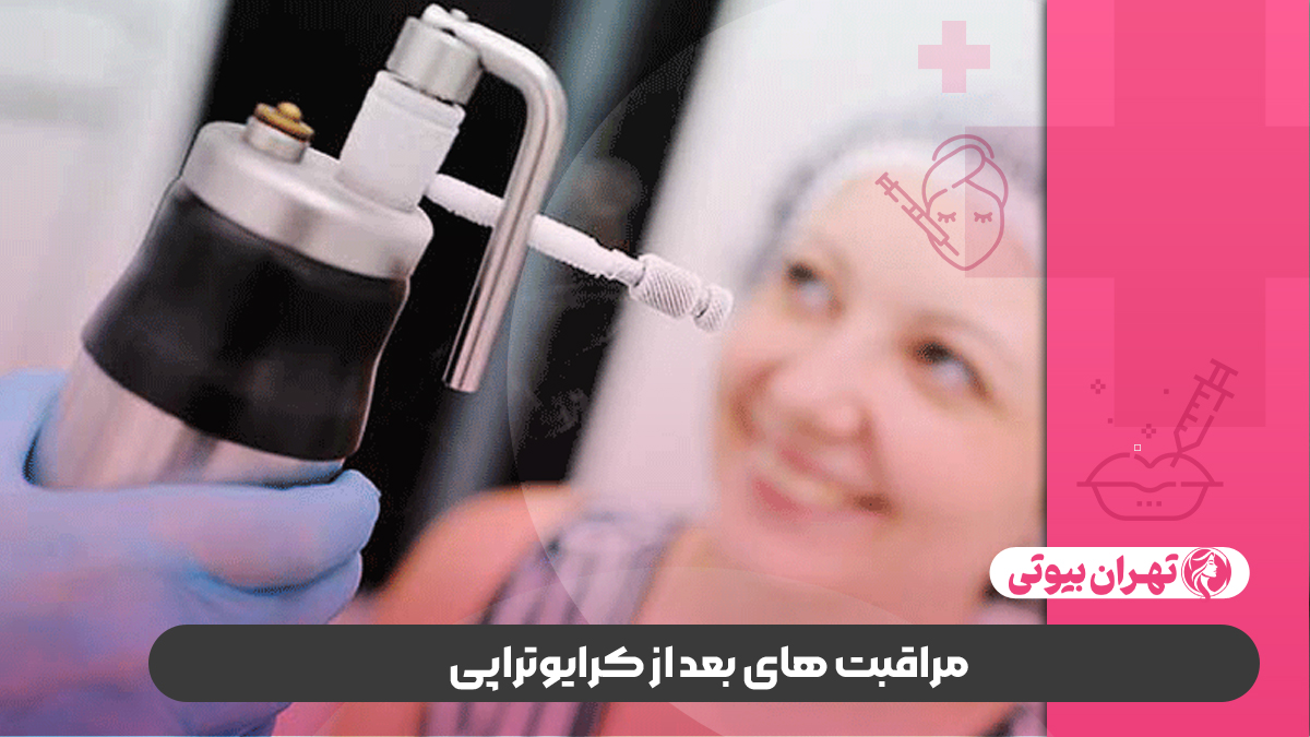 بهترین دکتر کرایوتراپی در غرب تهران