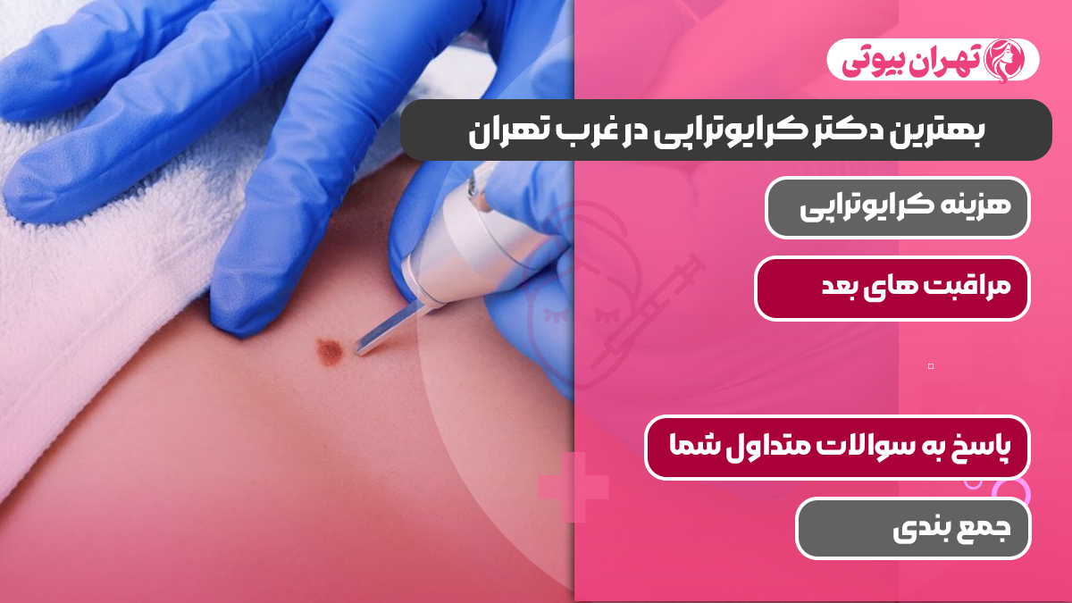 بهترین دکتر کرایوتراپی در غرب تهران