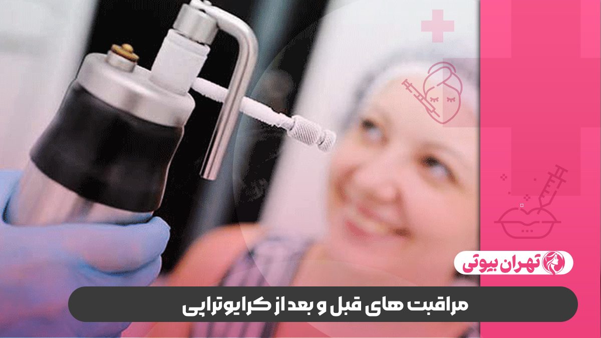 10 بهترین دکتر کرایوتراپی در شیراز