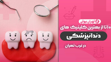 بهترین کلینیک دندانپزشکی در غرب تهران