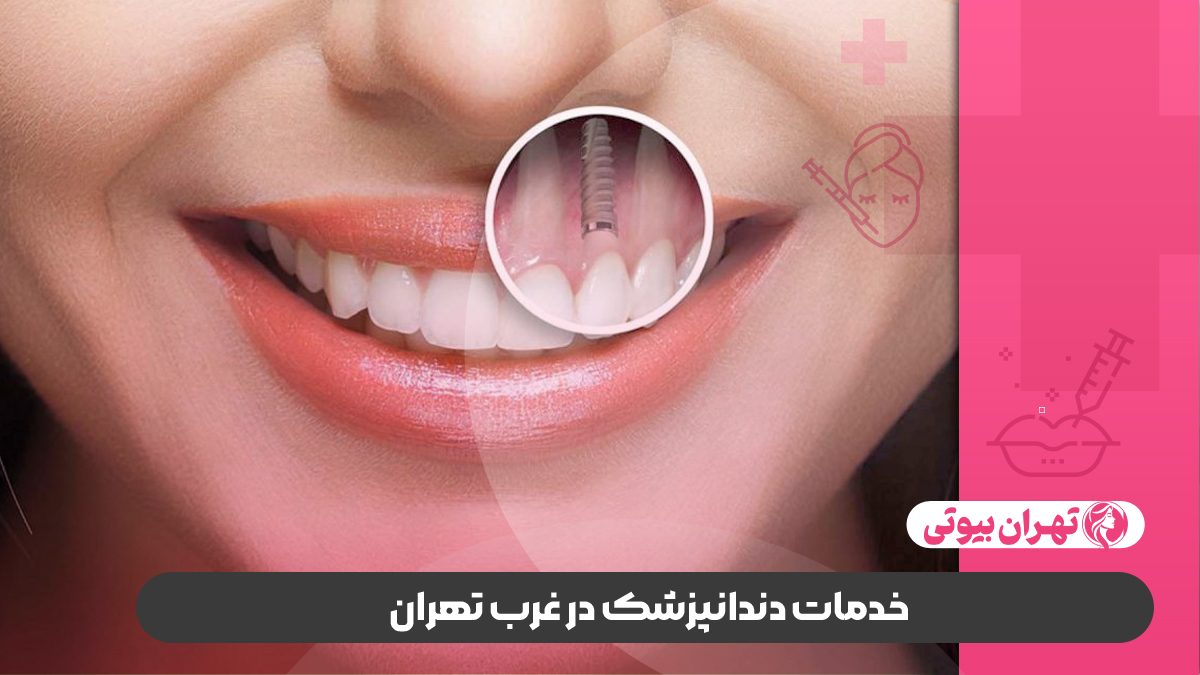 بهترین دندانپزشک در غرب تهران