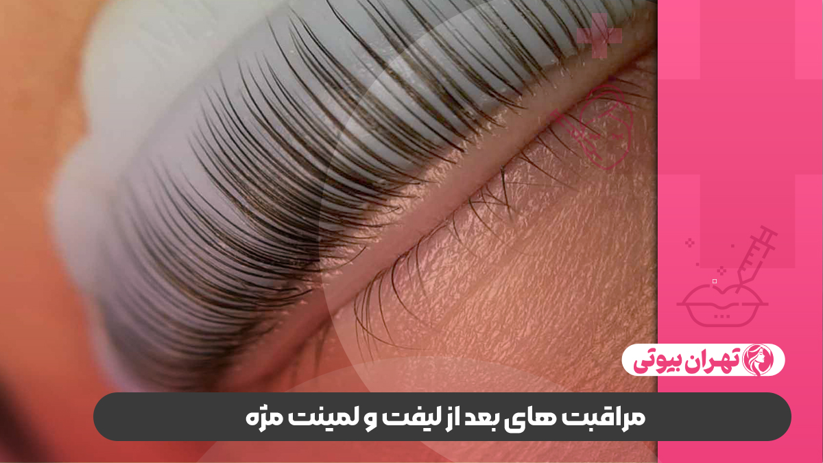 10 بهترین مرکز لیفت و لمینت مژه در شیراز