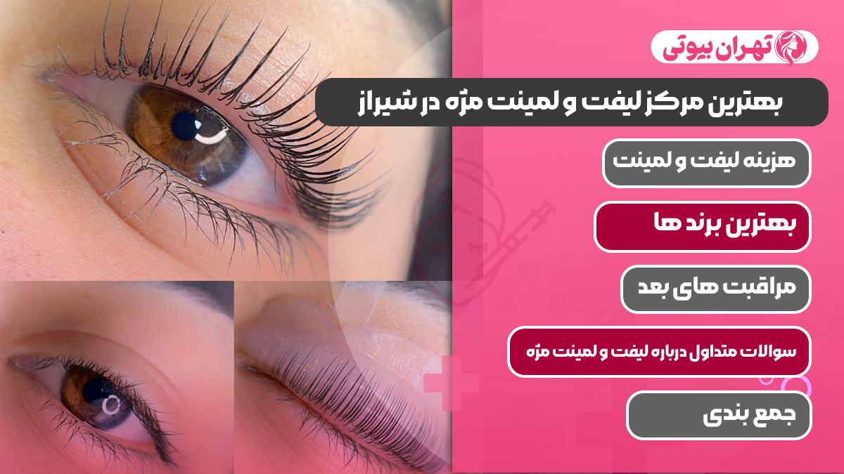 10 بهترین مرکز لیفت و لمینت مژه در شیراز