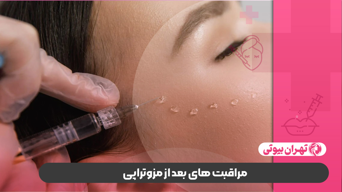 بهترین دکتر مزوتراپی صورت در غرب تهران
