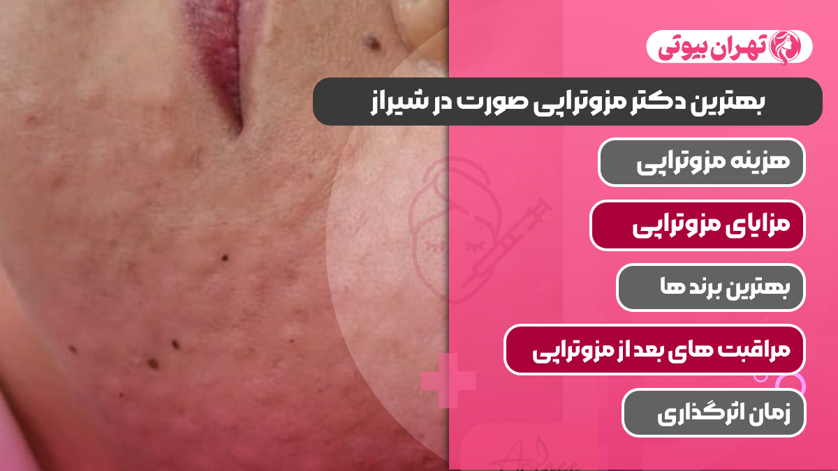 10 بهترین دکتر مزوتراپی صورت در شیراز