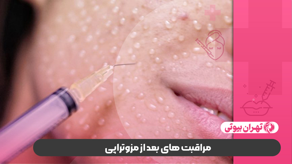 10 بهترین دکتر مزوتراپی صورت در شیراز