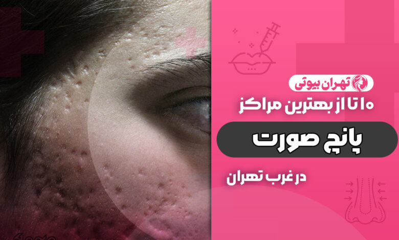 بهترین مرکز پانچ صورت در غرب تهران