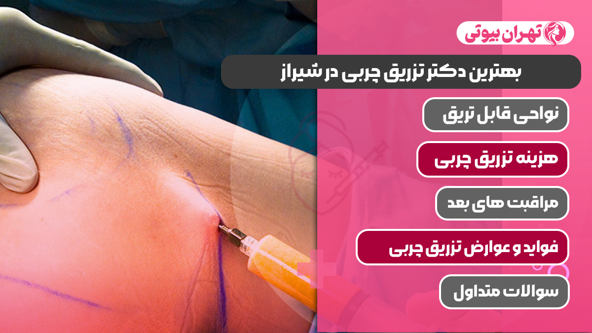 10 بهترین دکتر تزریق چربی در شیراز