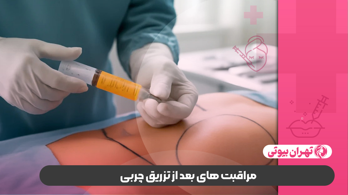 10 بهترین دکتر تزریق چربی در شیراز