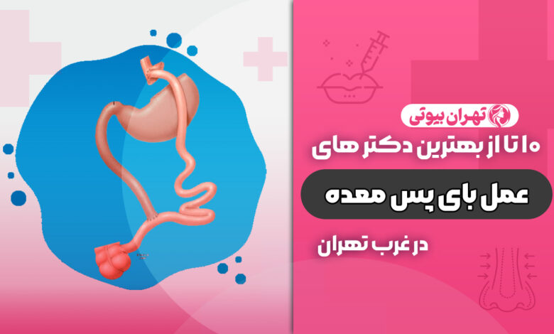 بهترین دکتر عمل بای پس معده در غرب تهران