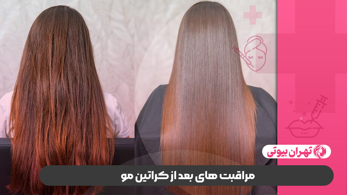 10 بهترین مرکز تخصصی کراتینه مو در شیراز
