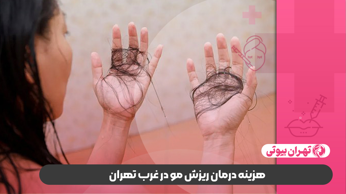 بهترین دکتر درمان ریزش مو در غرب تهران