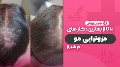 10 بهترین دکتر مزوتراپی مو در شیراز